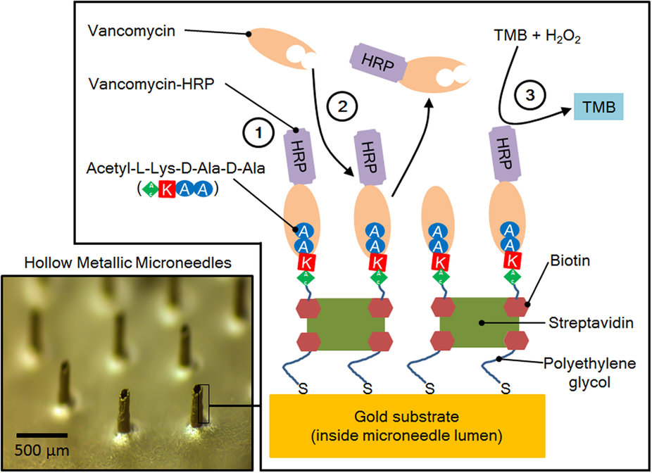Vancomycin-HRP is pre-loaded to the microneedle surface (1). Vancomycin present in the sample competes for the acetyl-L-lysine-D-alanine-D-alanine binding sites on the microneedle surface and displaces vancomycin-HRP (2). The enzyme-linked TMB assay is used to quantify (in the optofluidic detection chamber/waveguide) the level of bound vancomycin-HRP remaining on the surface (3).